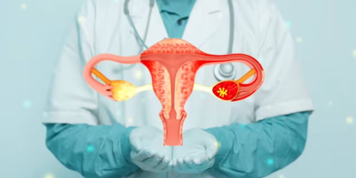 Ovarian cancer emerging as ‘silent killer’ in J&K