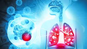 Smoking fuels Kashmir’s lung cancer rise: SKIMS Director