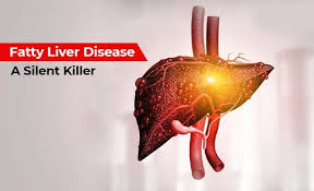 Fatty liver often silent in early stages, nearly one in every three in Valley affected: Doctors