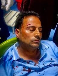 Attendant allegedly injures doctor at Pulwama Hospital