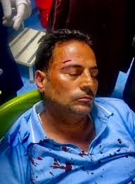 Attendant allegedly injures doctor at Pulwama Hospital