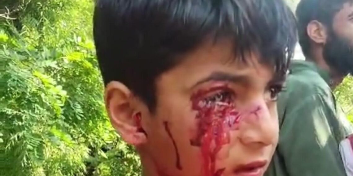 Stray dog attack at Faqir Gujree sparks safety concerns