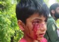Stray dog attack at Faqir Gujree sparks safety concerns