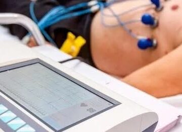 Lack of female ECG staff in J&K hospitals worries women patients
