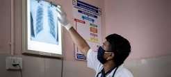 J&K gets Rs 173.44 Cr for TB elimination